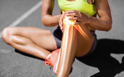 Woman with knee injury